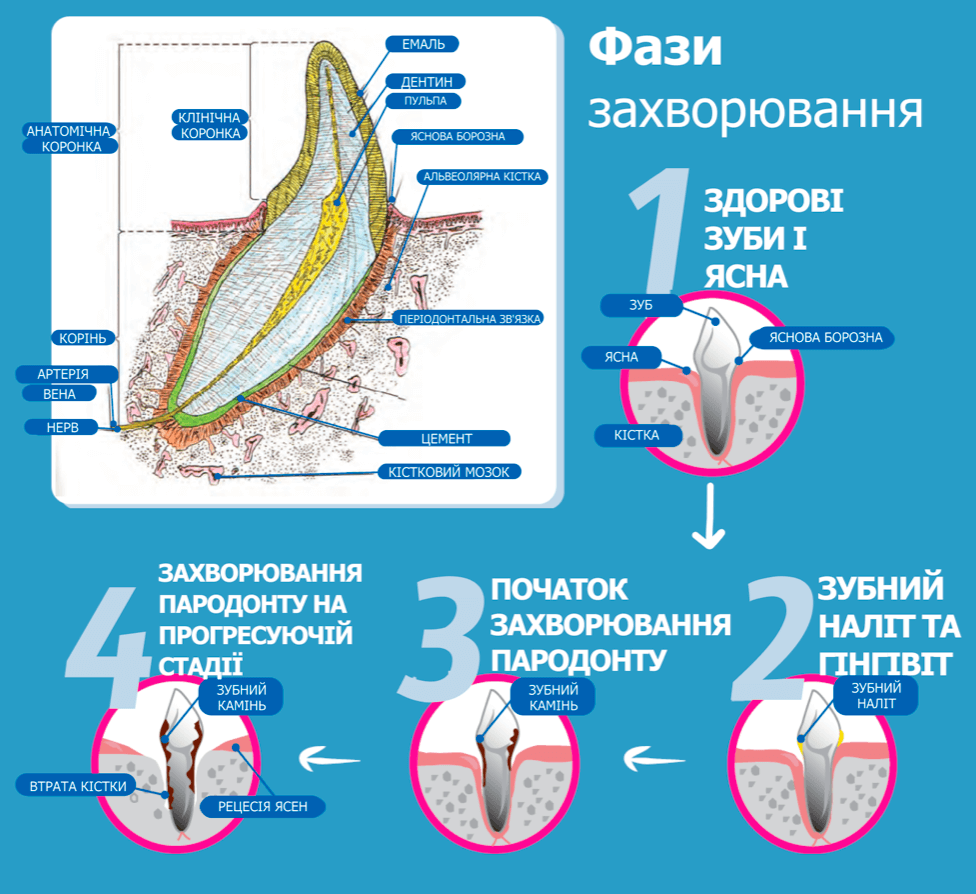 Фази захворювання